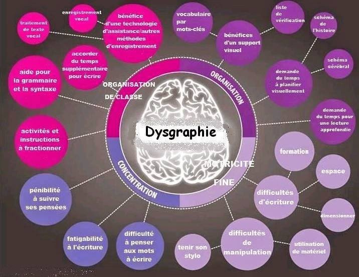 cerveau dys